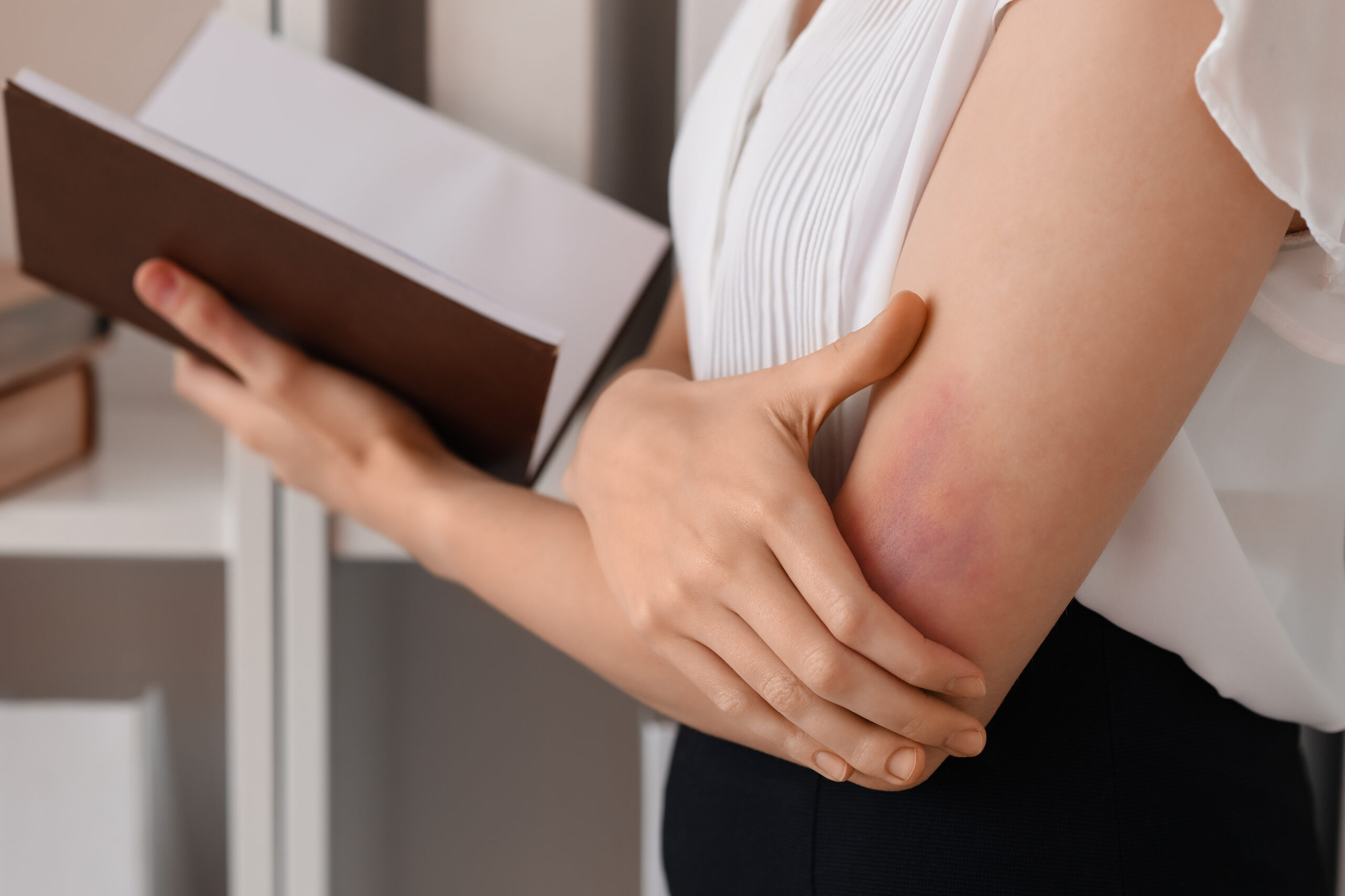 An employee holding a notebook in one hand and covering her bruised arm with the other hand, symbolising the hidden impact of domestic abuse on workplace wellbeing and performance
